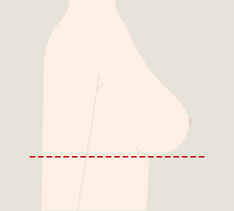 정상적인 가슴