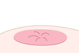 Step 01