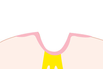 Step 02