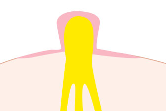 Step 01