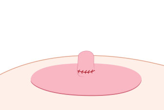 Step 02