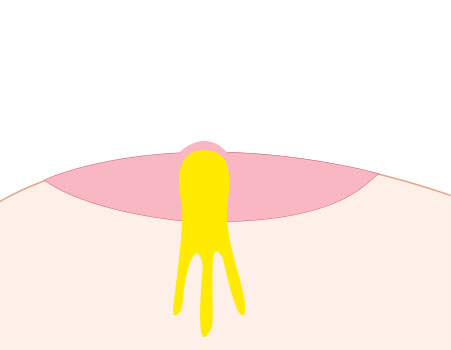 Step 01