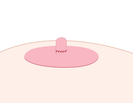 Step 02