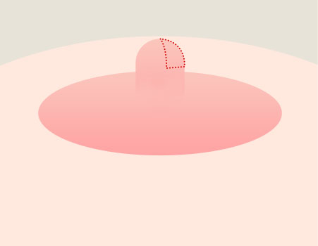 Step 01