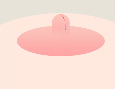 Step 02