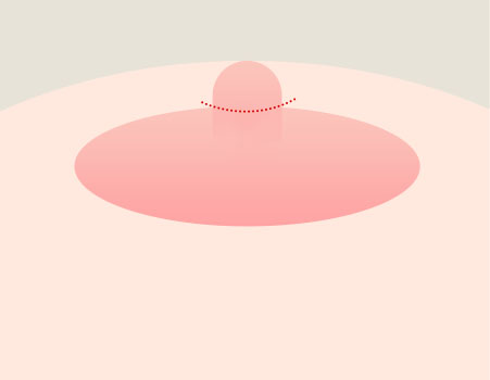 Step 01