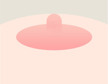 Step 02