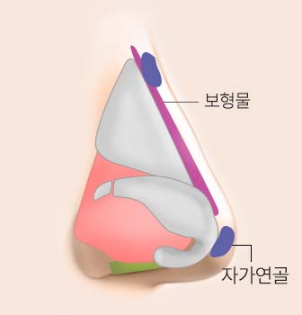 Step 01