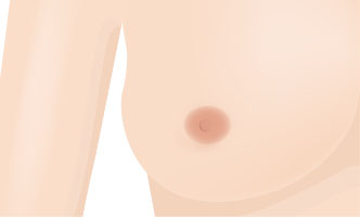 함물유두 2단계