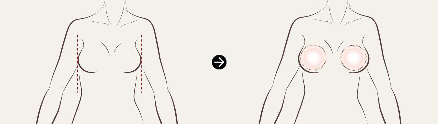 크기나 모양의 불만족