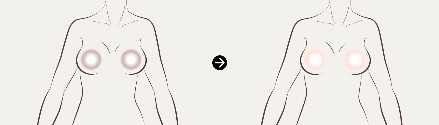 구형구축